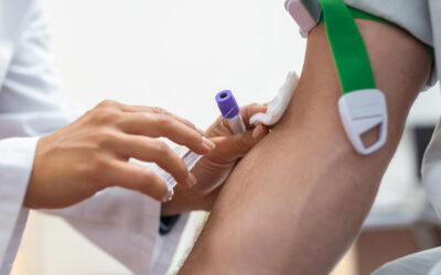 High Triglycerides Symptoms