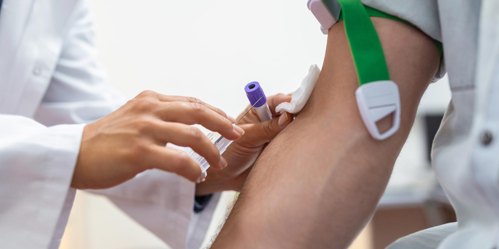 High Triglycerides: What Your Blood Test Results Mean and How to Lower Them