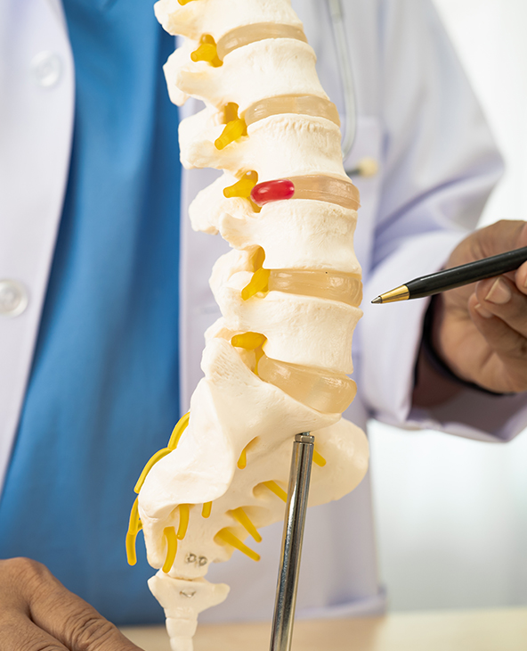 Vertebroplasty Surgery in Dehradun