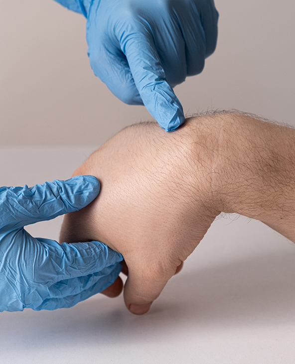 Cystic Hygroma Treatment in Dehradun