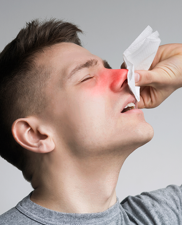 Nasal Polyps Treatment in Dehradun