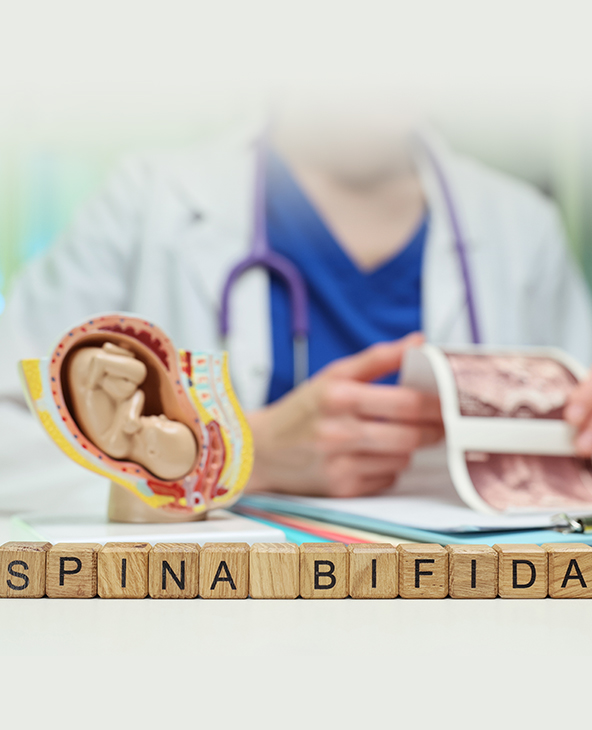 Spina Bifida Treatment in Dehradun