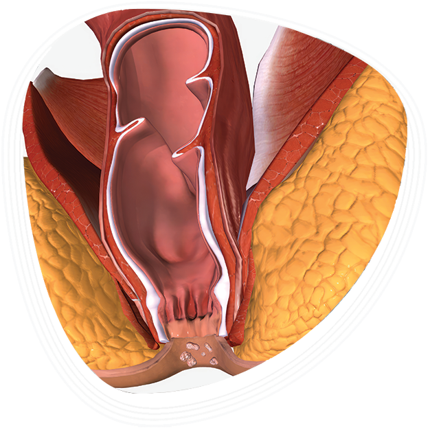 Why Choose Graphic Era Hospital for Imperforate Anus Treatment in Dehradun